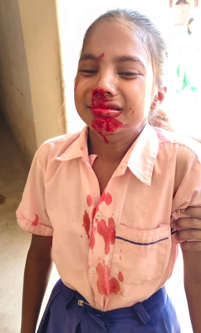 Giridih News: गर्मी से मध्य विद्यालय बंदखारो की तीन छात्राओं की नाक से निकला खून, एक बीमार पड़ी