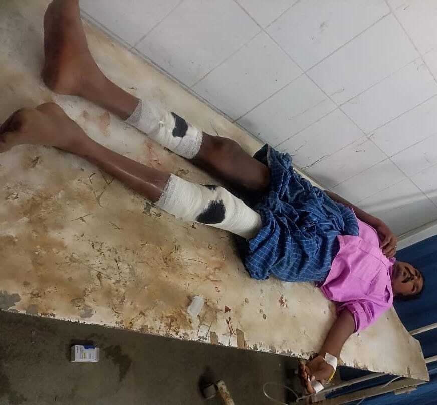 सड़क हादसों में दो लोग घायल