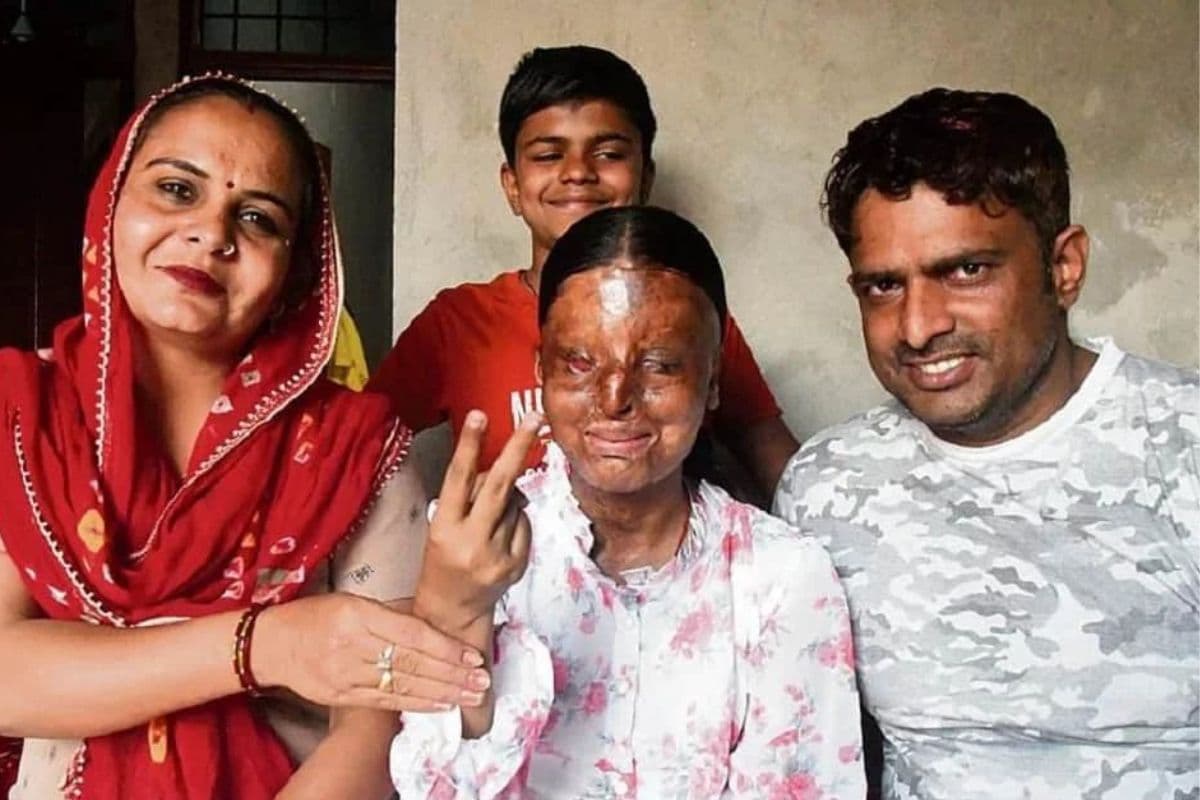 CBSE Topper 2025: एसिड अटैक में चली गई आंखें, सीबीएसई में रच दिया इतिहास, 12वीं में 95.6% मार्क्स