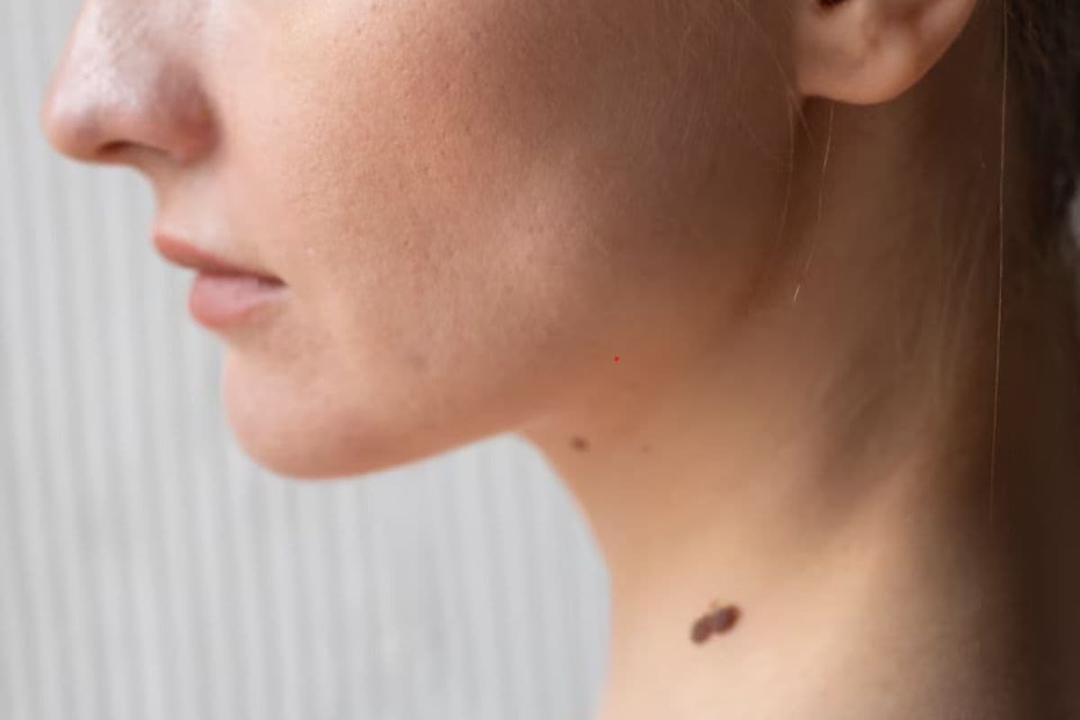 Mole Astrology : भाग्यशाली व्यक्ति के ही होते है शरीर के इन जगहों पर तिल, देते है शुभ संकेत