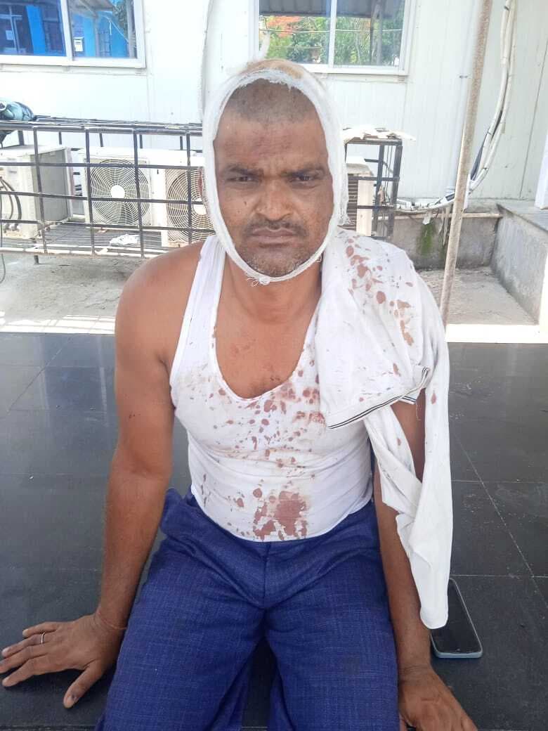 धुसमुरी विशनपुर में भूमि विवाद मारपीट, एक जख्मी