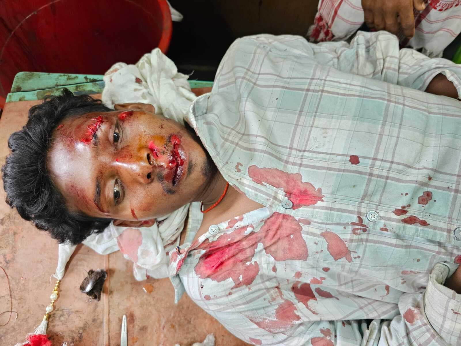 दो सड़क दुर्घटनाओं में महिला समेत चार घायल