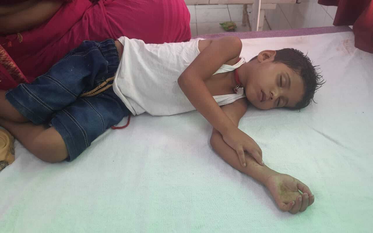 अनियंत्रित बाइक के धक्का से बालक घायल, रेफर