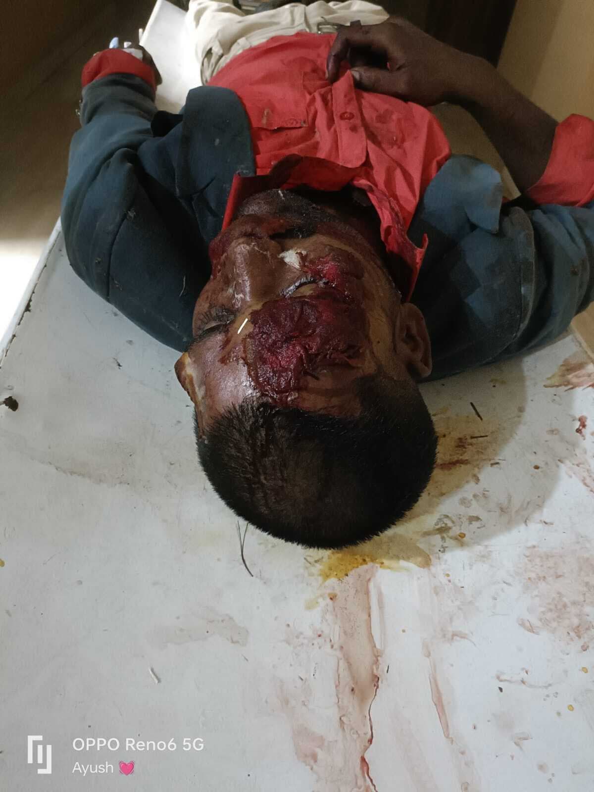 ससुराल जा रहे बाइक सवार युवक सड़क दुर्घटना में जख्मी