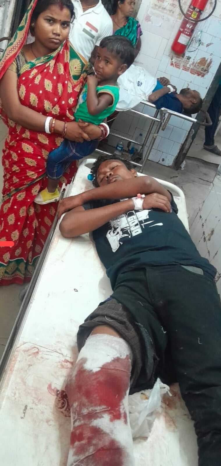 East Singbhum News : कार की चपेट में आने से स्कूटी सवार दो युवक गंभीर