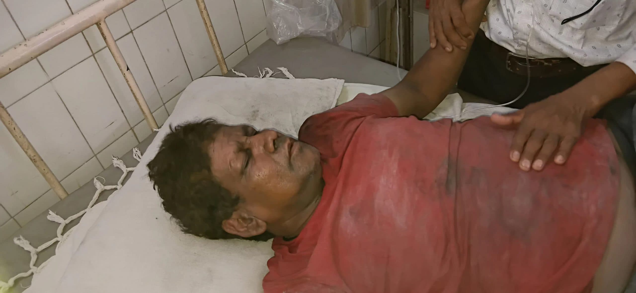 Bokaro News : मालगाड़ी से कोयला उतारने के दौरान हाइटेंशन तार से झुलसा व्यक्ति