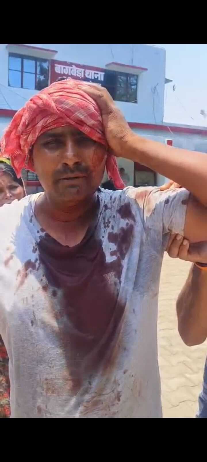 Jamshedpur news. बागबेड़ा में पानी भरने को लेकर विवाद के बाद हाथापाई, एक का सिर फटा