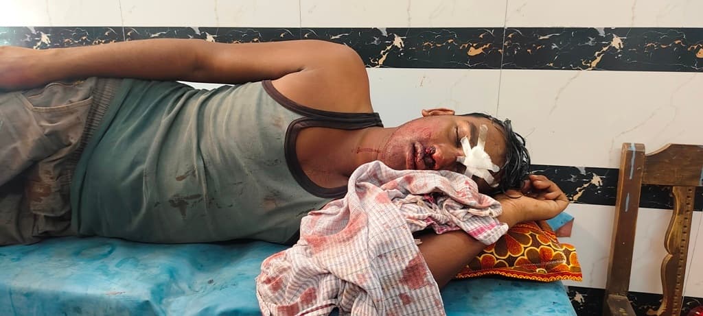 सड़क दुर्घटना में बाइक सवार युवक जख्मी, रेफर