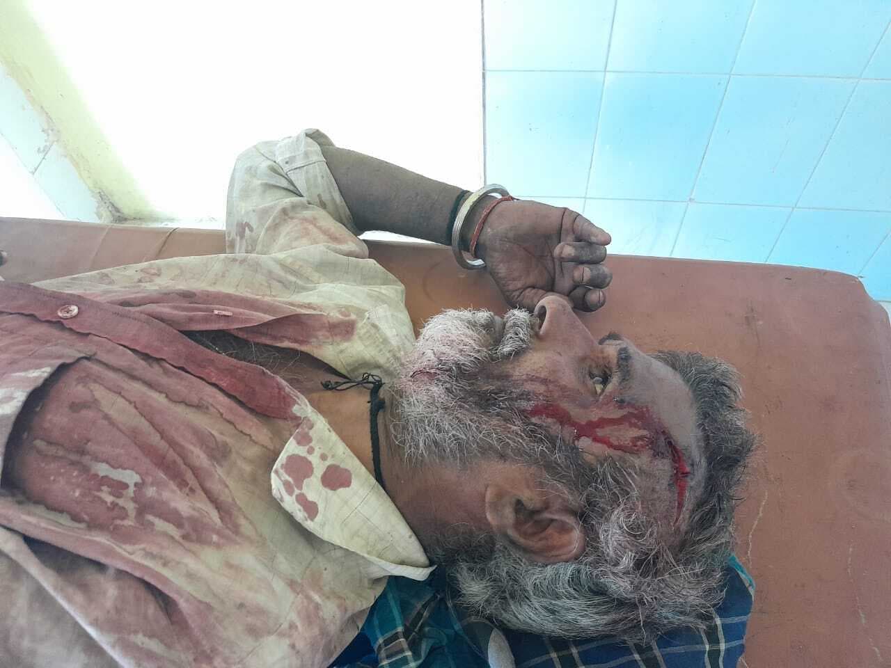 Bhagalpur News: भ्रमरपुर में जमीन विवाद में बुजुर्ग का सिर फोड़ा