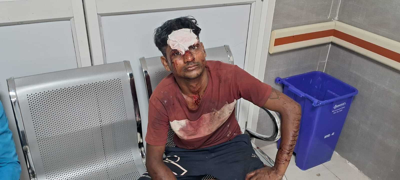 अलग-अलग सड़क दुर्घटना में बाप-बेटा सहित चार घायल, सदर अस्पताल में चल रहा इलाज