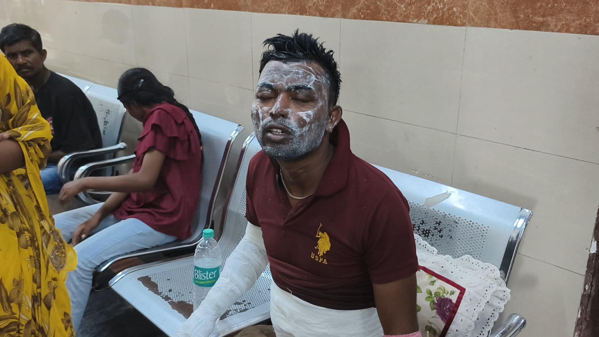 जीजा ने साला पर पेट्रोल छिड़क लगायी आग, स्थिति नाजुक