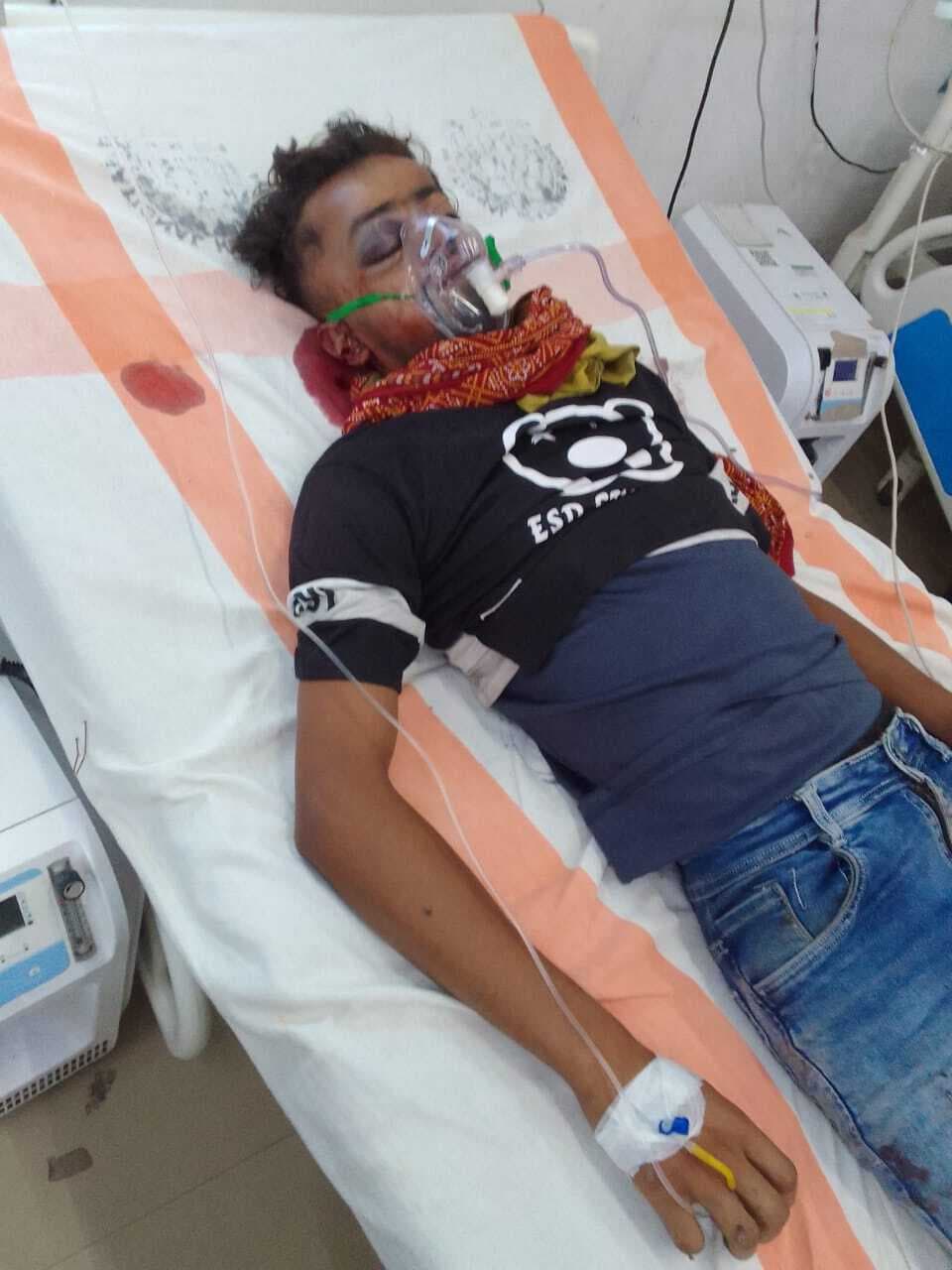 सड़क किनारे पेड़ से टकरायी बाइक, एक युवक की मौत, एक घायल