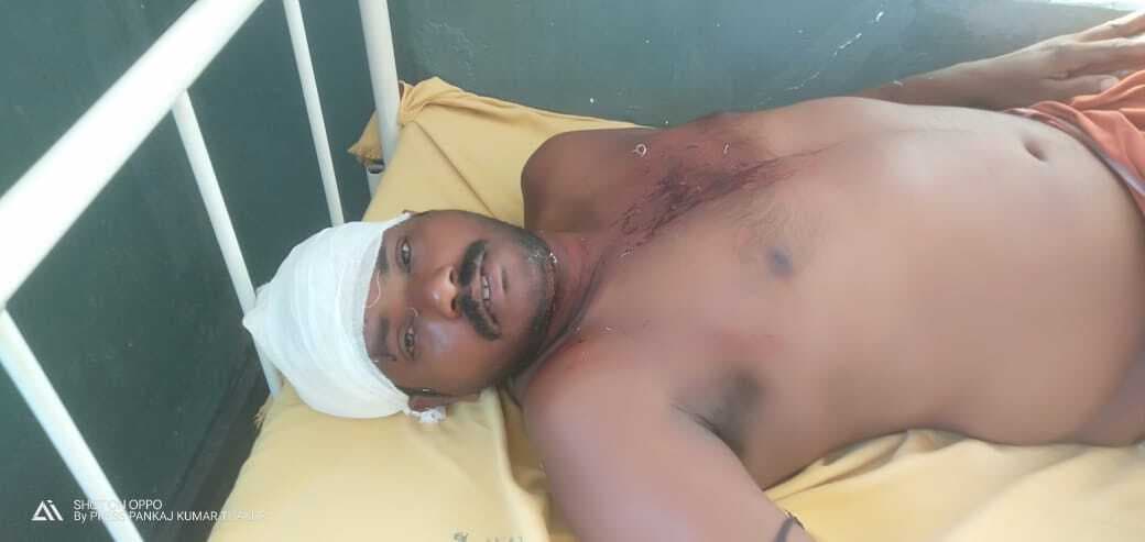 रास्ता विवाद में सहोदर भाइयों के बीच मारपीट