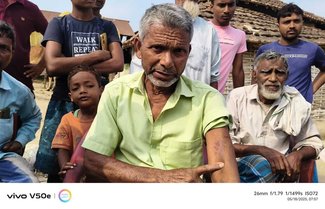 निजी मदरसा में बच्चे की पिटाई करने का लगा आरोप