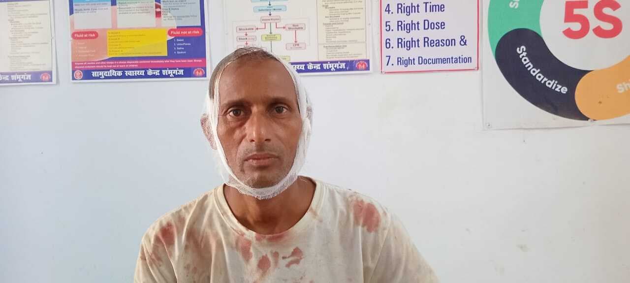 जमीन विवाद में दो पक्षों के बीच हिंसक झड़प, एक महिला सहित तीन जख्मी