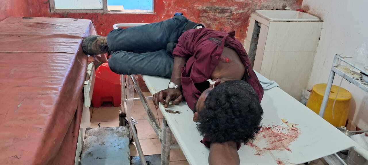 बाइक से गिरकर चालक हुआ जख्मी