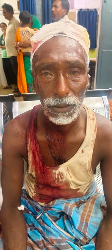 दो गोतिया में हुई मारपीट, आधा दर्जन जख्मी