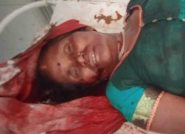 दो बाइक की आमने-सामने की टक्कर, महिला की मौत, युवक घायल