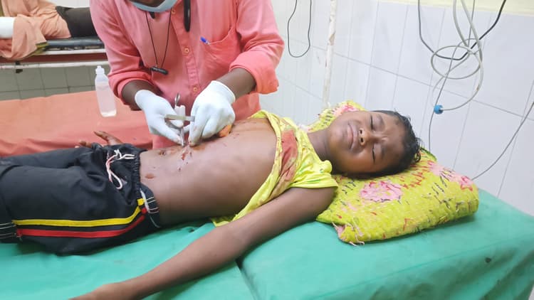 Dhanbad News : मोबाइल की बैट्री फटने से मासूम घायल