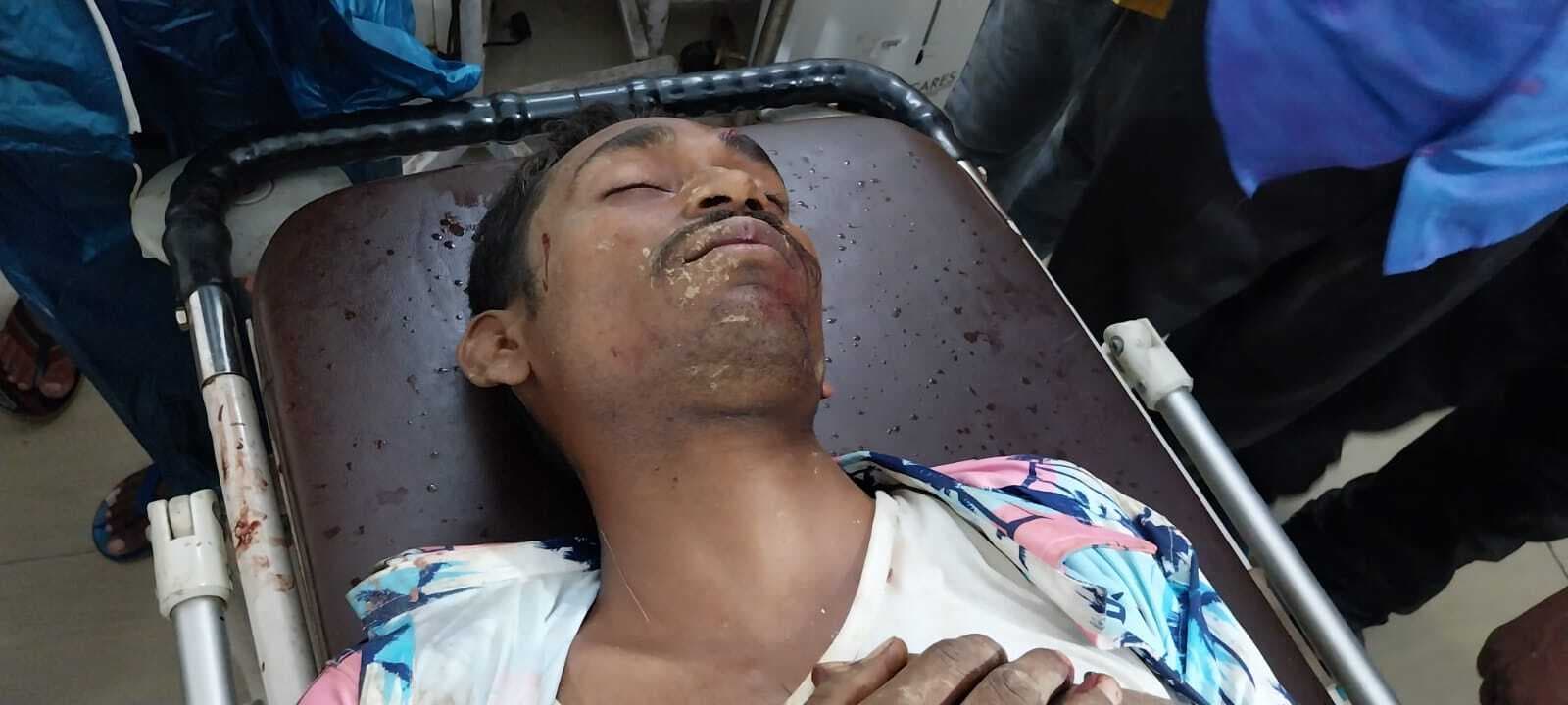 Seraikela Kharsawan News : दो सड़क हादसों में नाबालिग और तीन युवक हुए गंभीर