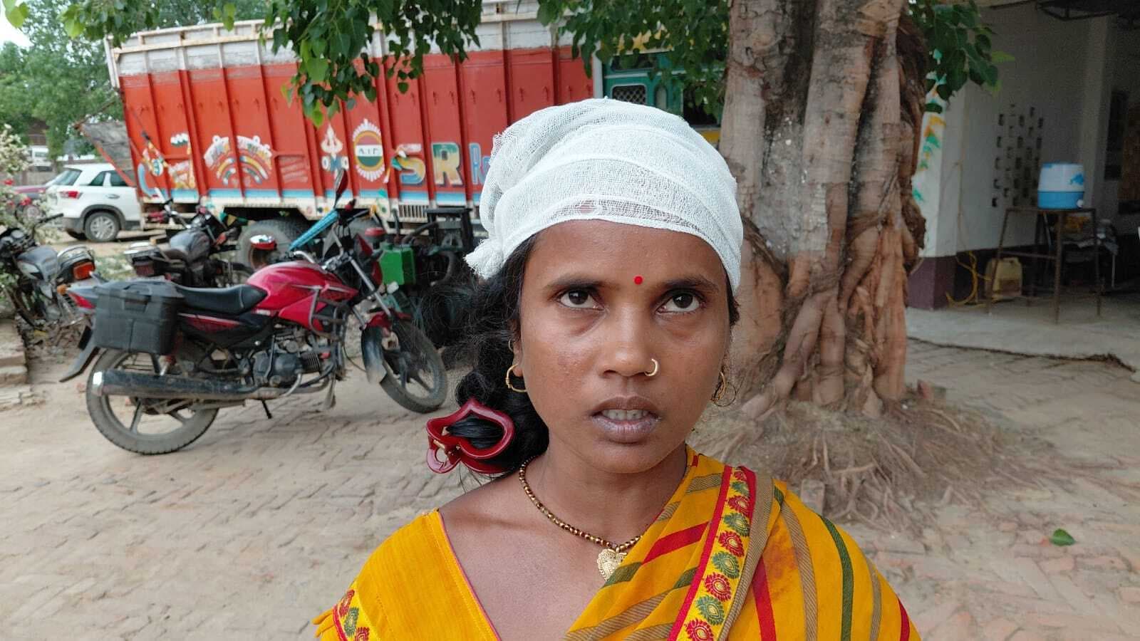 आपसी विवाद में देवर ने भाभी में पीटा, घायल