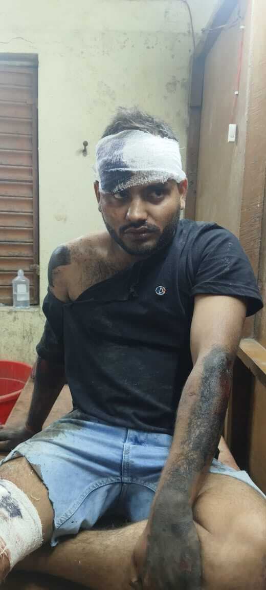 बाइक पलटी, दंपती समेत पुत्र घायल