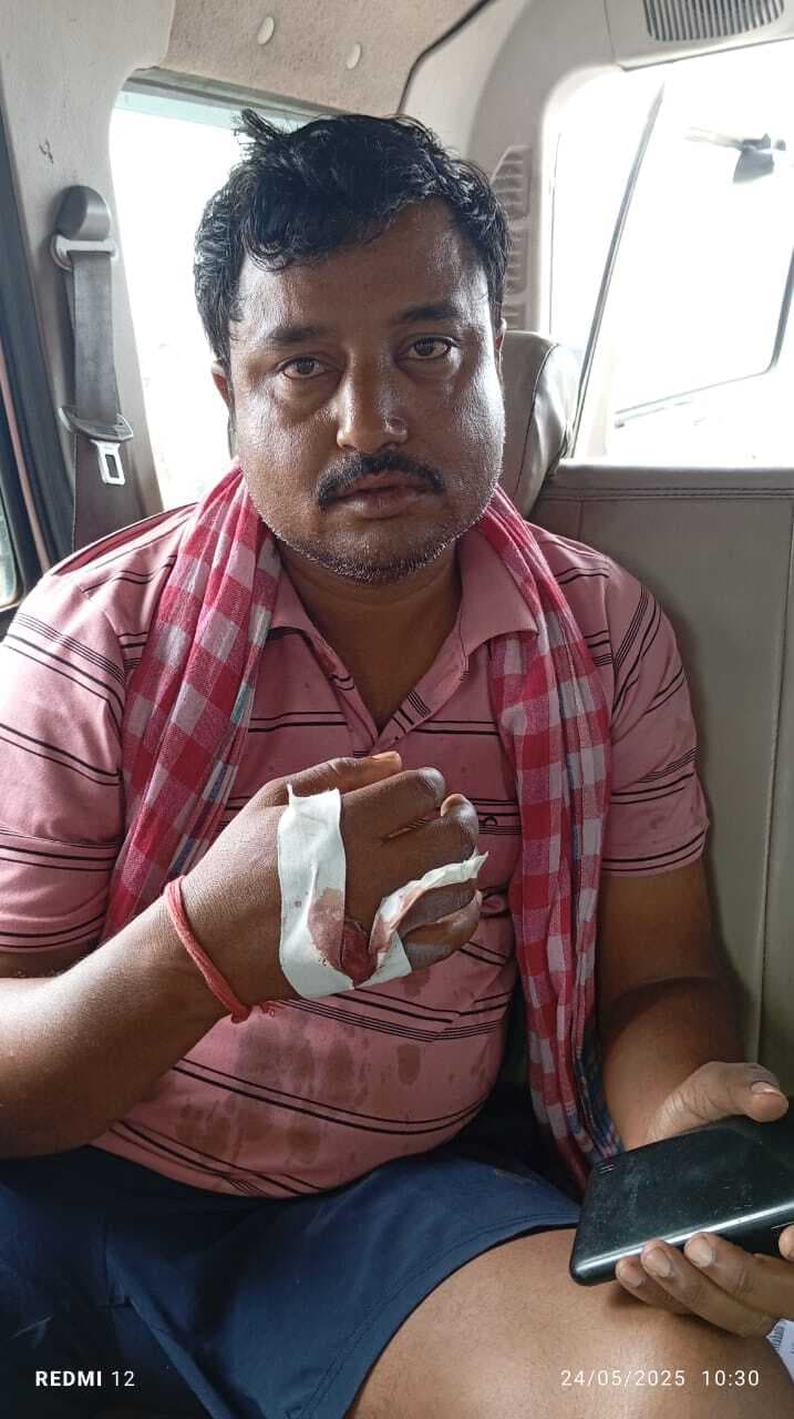 Dhanbad News: आजसू के प्रखंड सचिव को मारपीट कर किया घायल