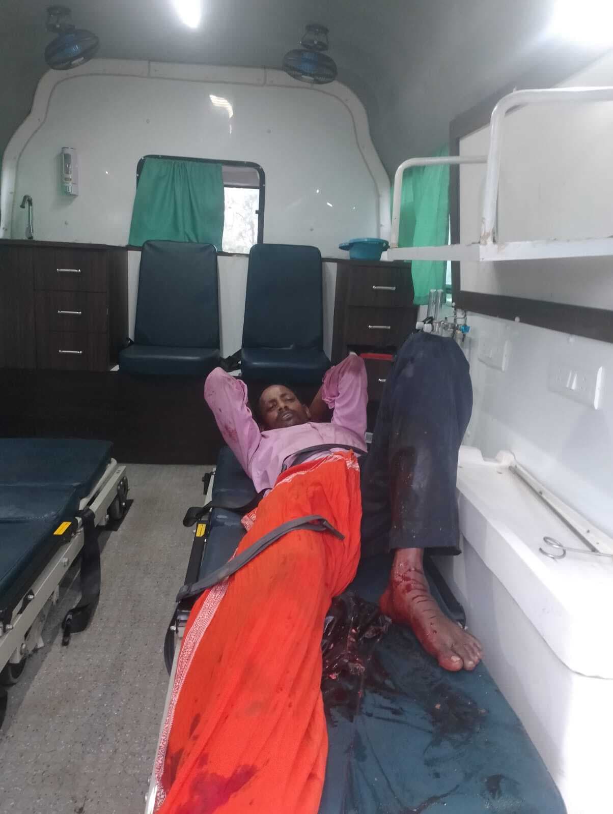 Dhanbad News: ट्रक की चपेट में आकर बाइक सवार का पैर कुचला, रांची रेफर