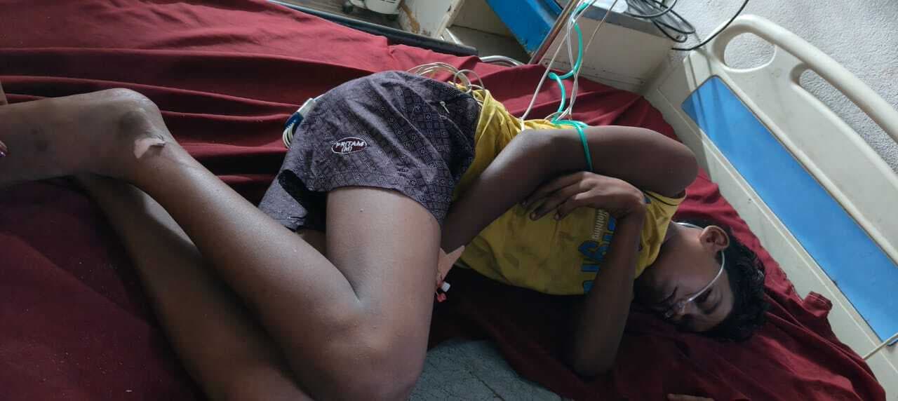 हाईटेंशन तार की चपेट में आने से 12 वर्षीय बालक झुलसा