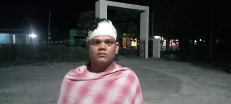 ठाकुरगंगटी भाइयों के बीच खूनी संघर्ष, दंपती घायल, मामला दर्ज