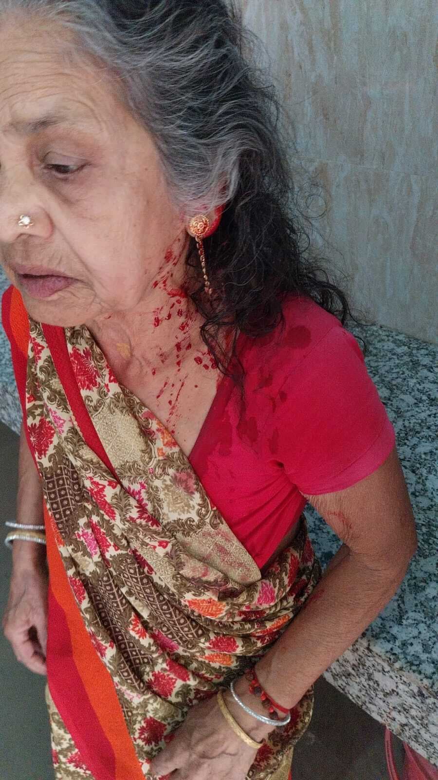 पत्नी के साथ मिलकर पुत्र ने वृद्ध मां को पीटकर किया जख्मी