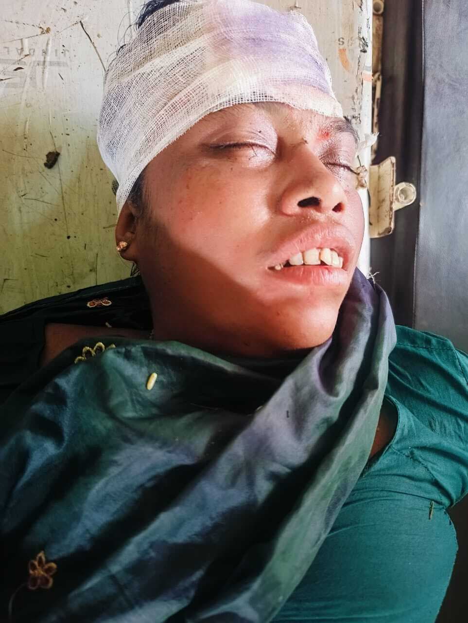 अज्ञात वाहन की चपेट में आकर बाइक सवार तीन लोग घायल