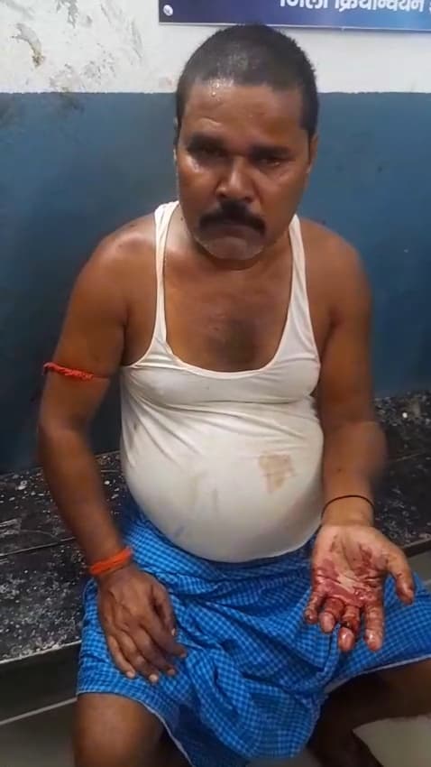 जमीन विवाद में मारपीट, घायल रेफर