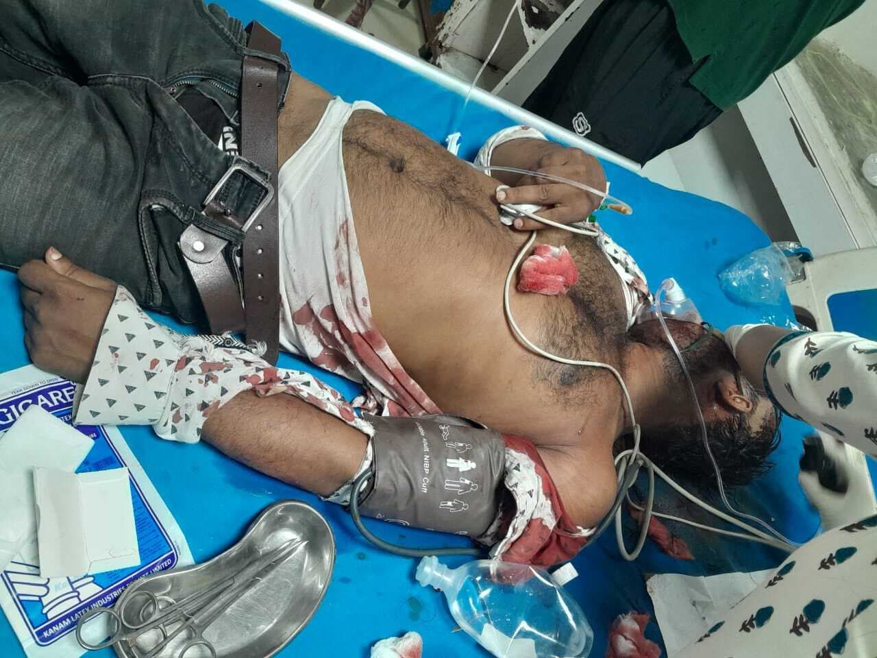 बाइक और ट्रैक्टर की टक्कर में आधा दर्जन लोग गंभीर रूप से घायल