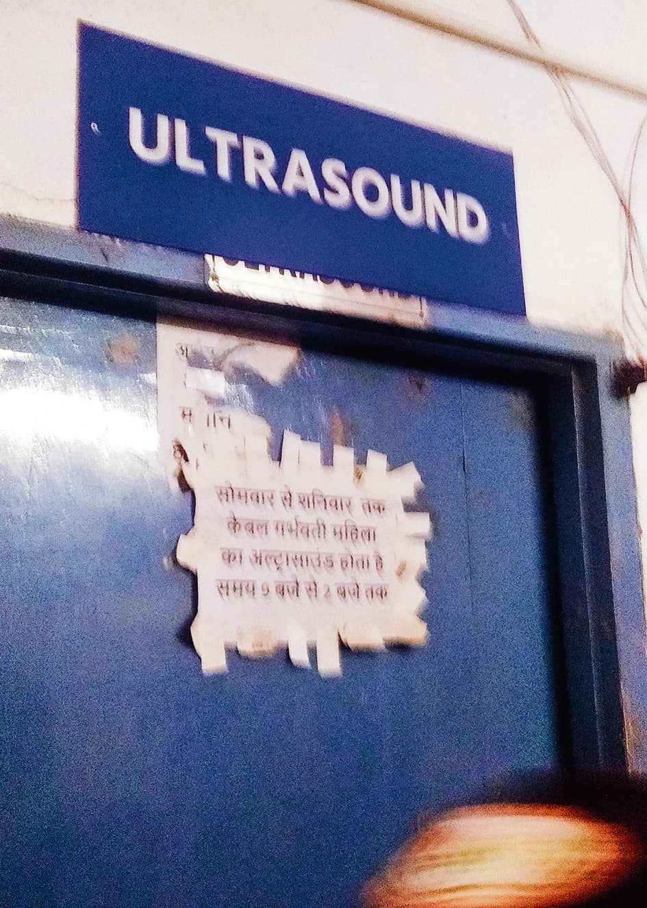 hajipur news. सदर अस्पताल में अल्ट्रासाउंड नहीं होने से परेशान हो रहे मरीज