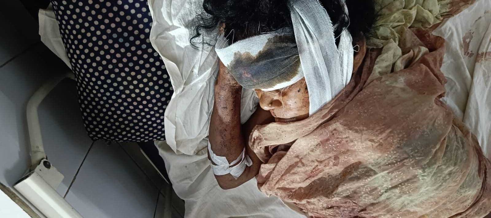 महिला को चाकू मार कर गंभीर रूप से किया घायल