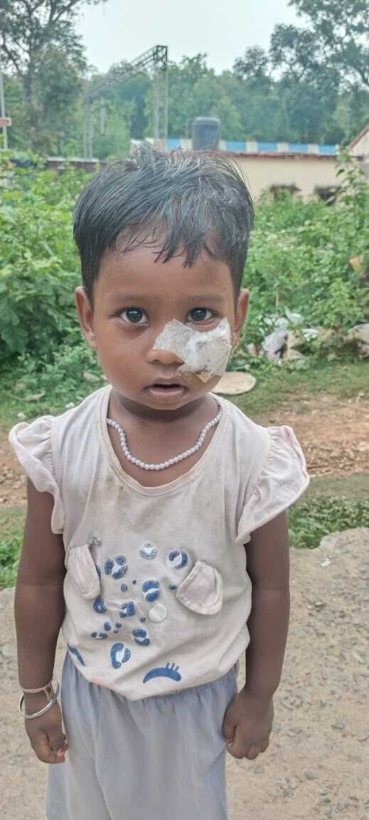 Chaibasa News : गोइलकेरा स्टेशन में बेंच से गिरकर बच्ची हुई घायल