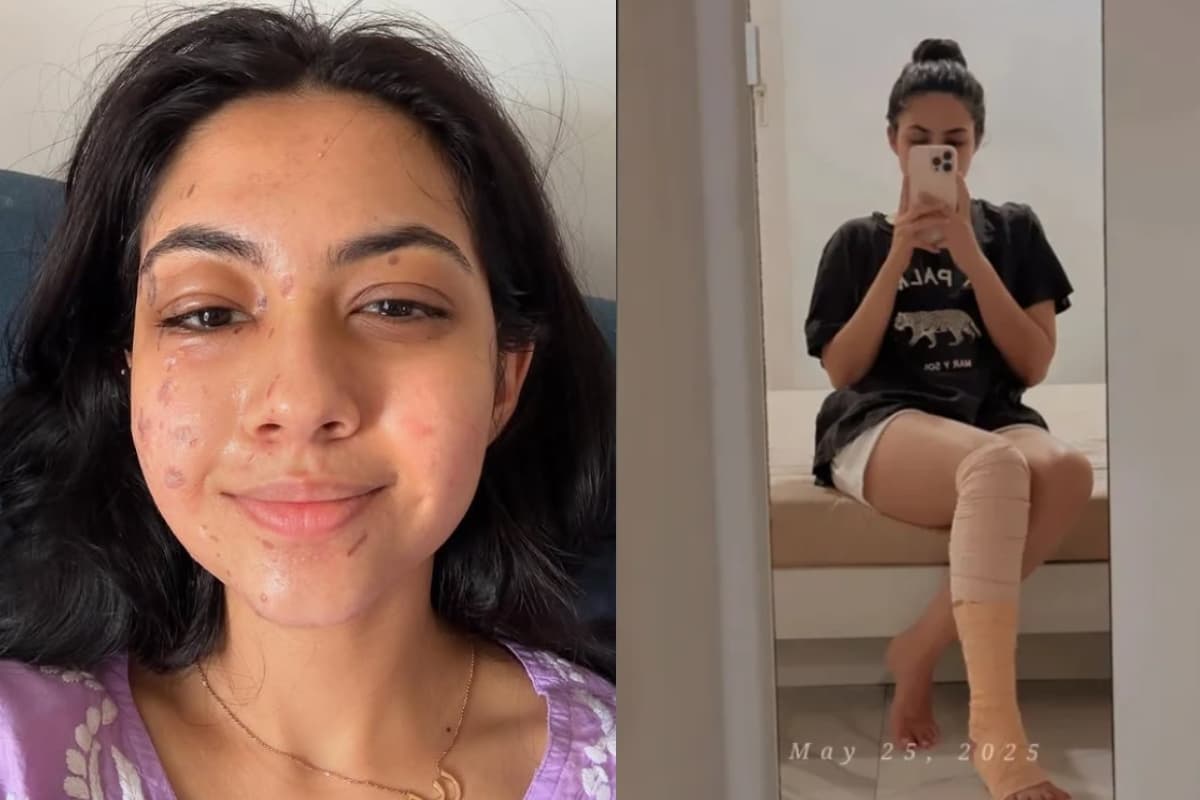 Reem sameer shaikh injured