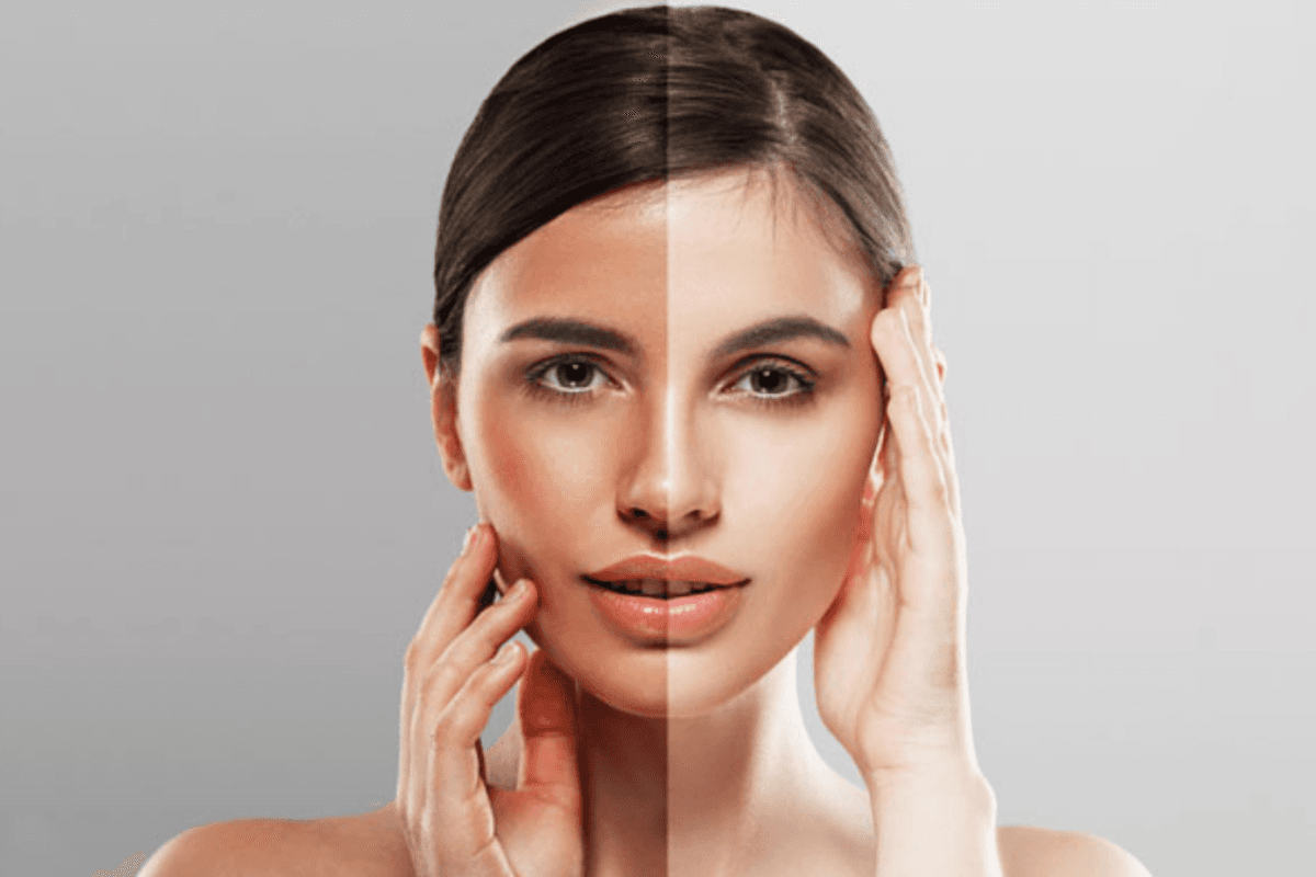 Best Tips for Suntan Removal