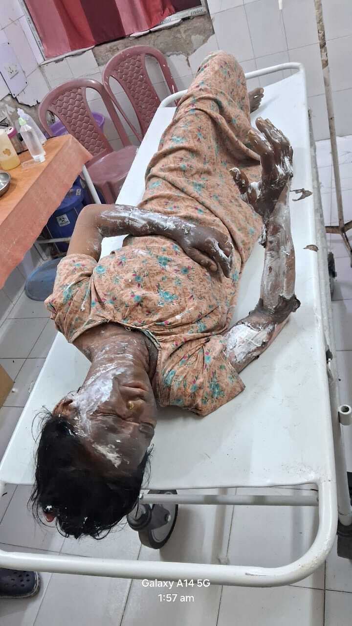 आग की चपेट में आने से मां-बेटा जख्मी