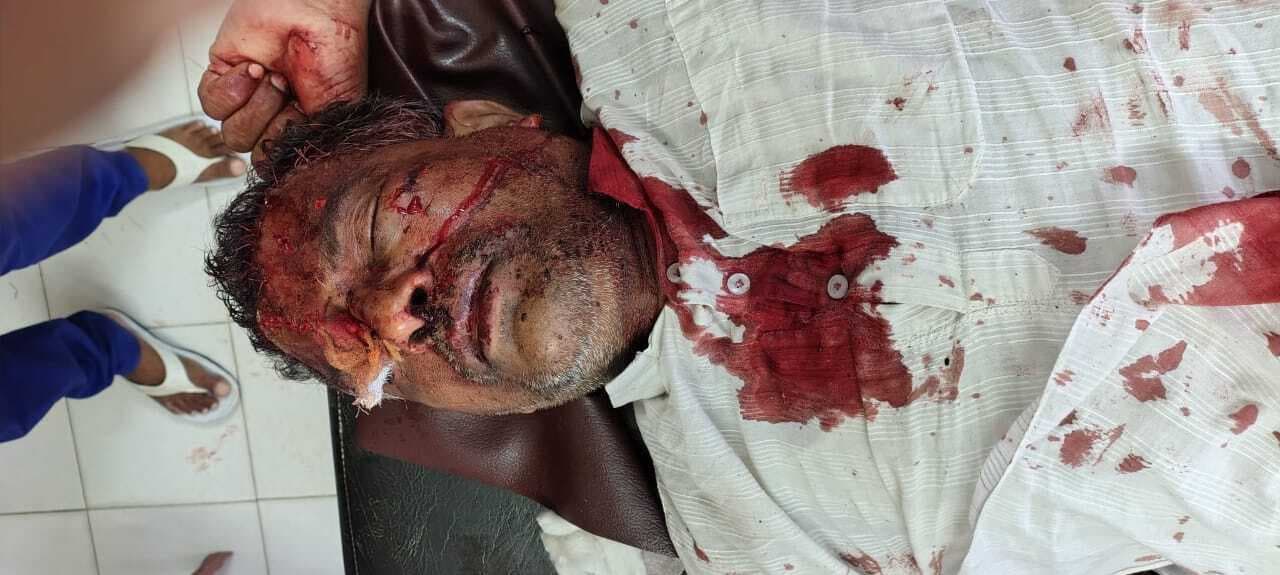 टेंपो व टोटो की टक्कर में चार यात्री घायल, एक भागलपुर रेफर