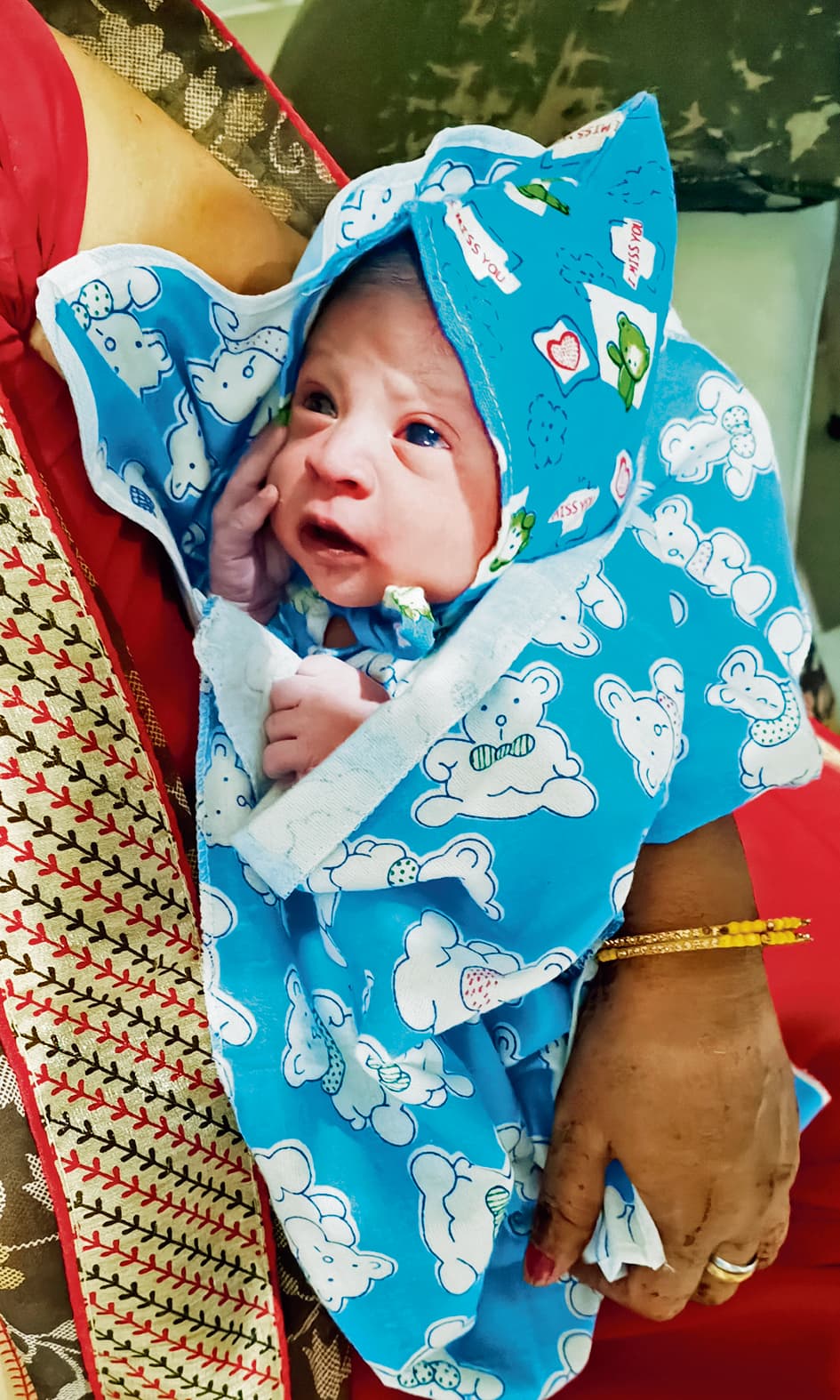 Gaya News : नवजातों में पीलिया आम, पर अनदेखी बना देता है गंभीर