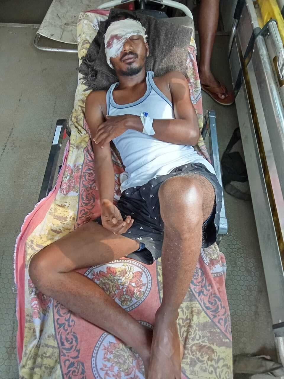 श्रीअमड़ा गांव के पास युवकों के दो गुट आपस में भिड़े, जमकर हुई मारपीट