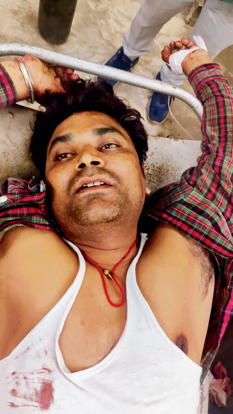 Gopalganj News  : मिंज स्टेडियम के पास बदमाशों ने युवक को चाकू घोंपा, मेडिकल कॉलेज रेफर