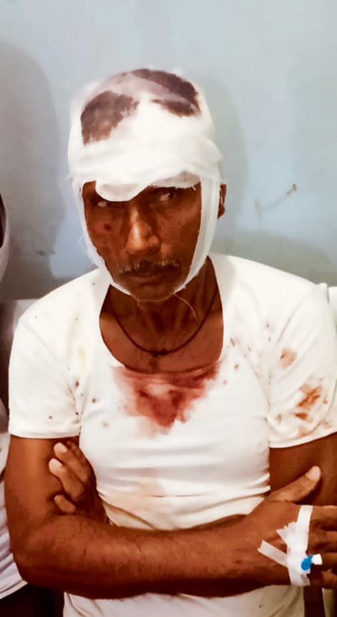 Gopalganj News  : फुलवरिया में ऑर्केस्ट्रा के दौरान कुर्सी के विवाद में खूनी संघर्ष, 12 घायल, दो की हालत नाजुक