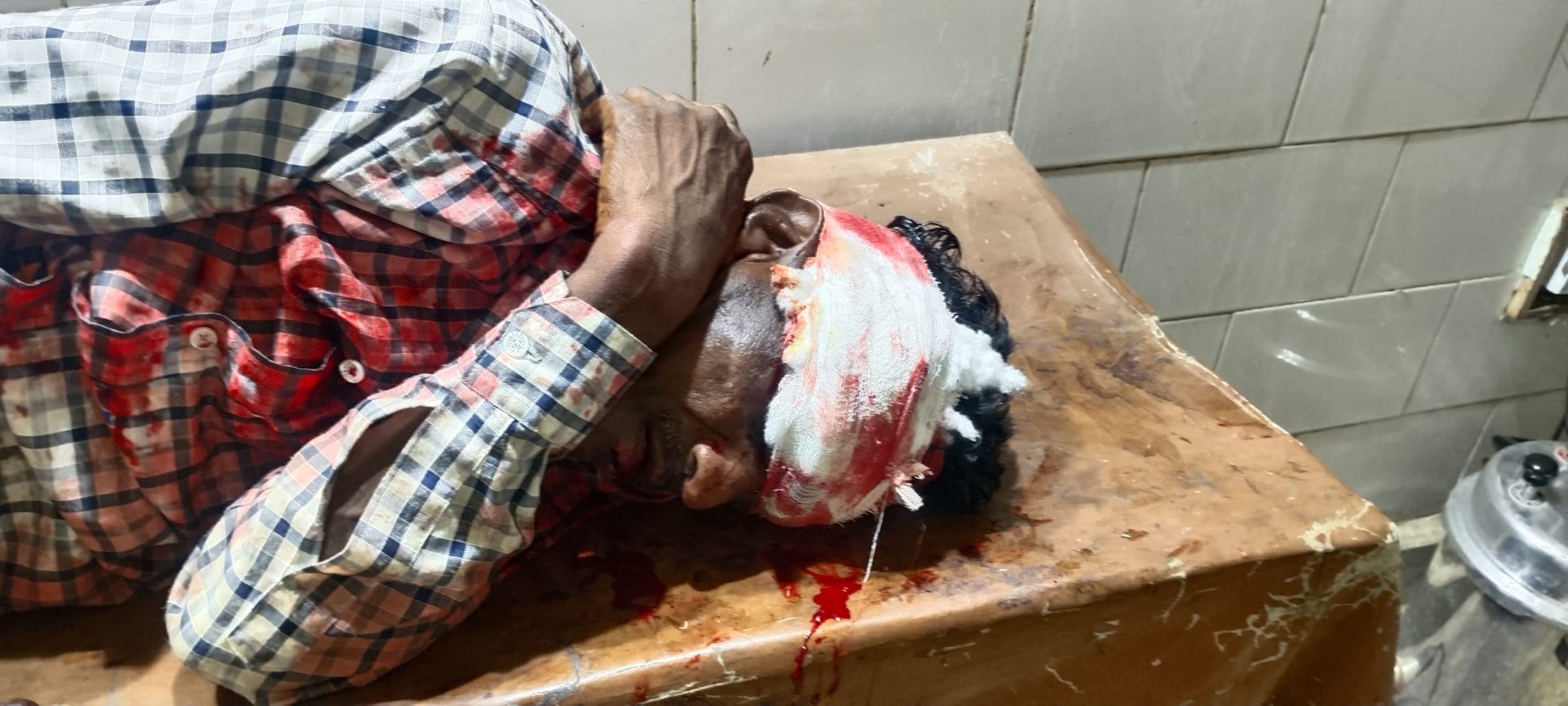 वाहन के धक्के से व्यक्ति घायल, धनबाद रेफर