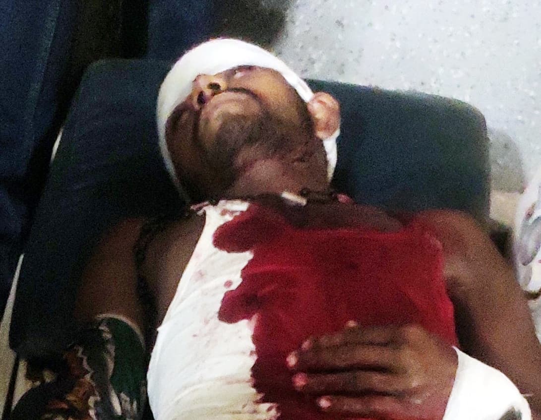 चाकू मारकर युवक को किया लहूलुहान, हालत नाजुक