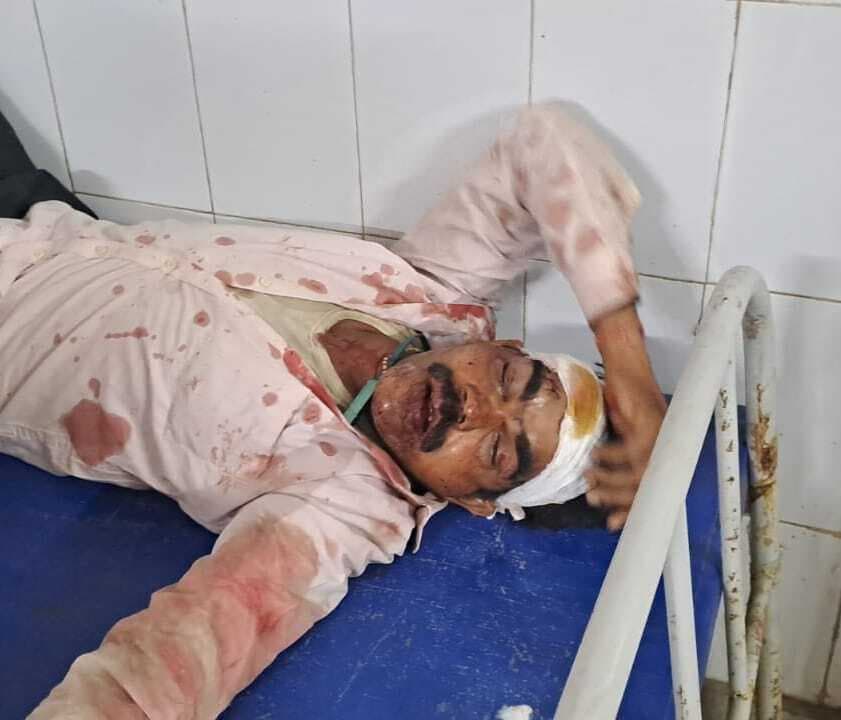 दो बाइक की आमने-सामने की टक्कर, चार लोग घायल