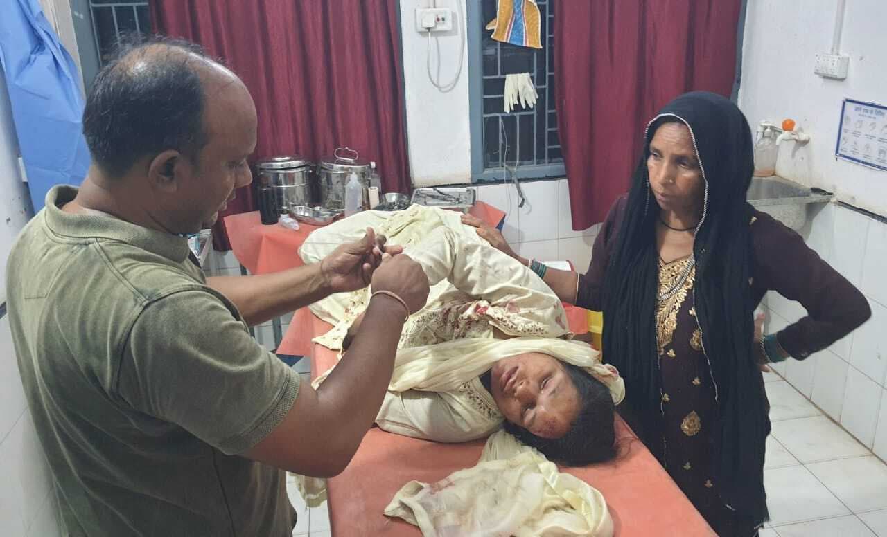 चलती बाइक से गिरकर महिला गंभीर रूप से घायल, बांका रेफर