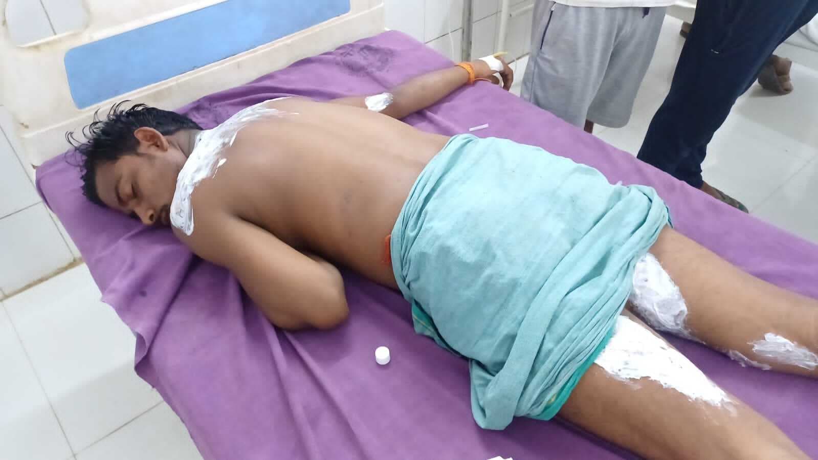 करंट लगने से विद्युत कर्मी हुआ जख्मी